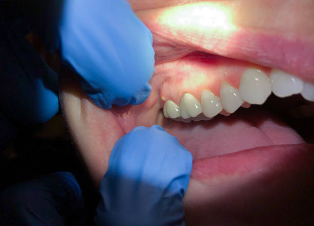 Best Pediatric Emergency Dentist in Cedartown, GA